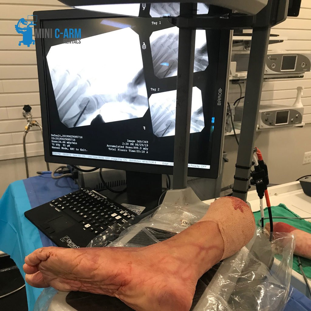 Mini c arm rental