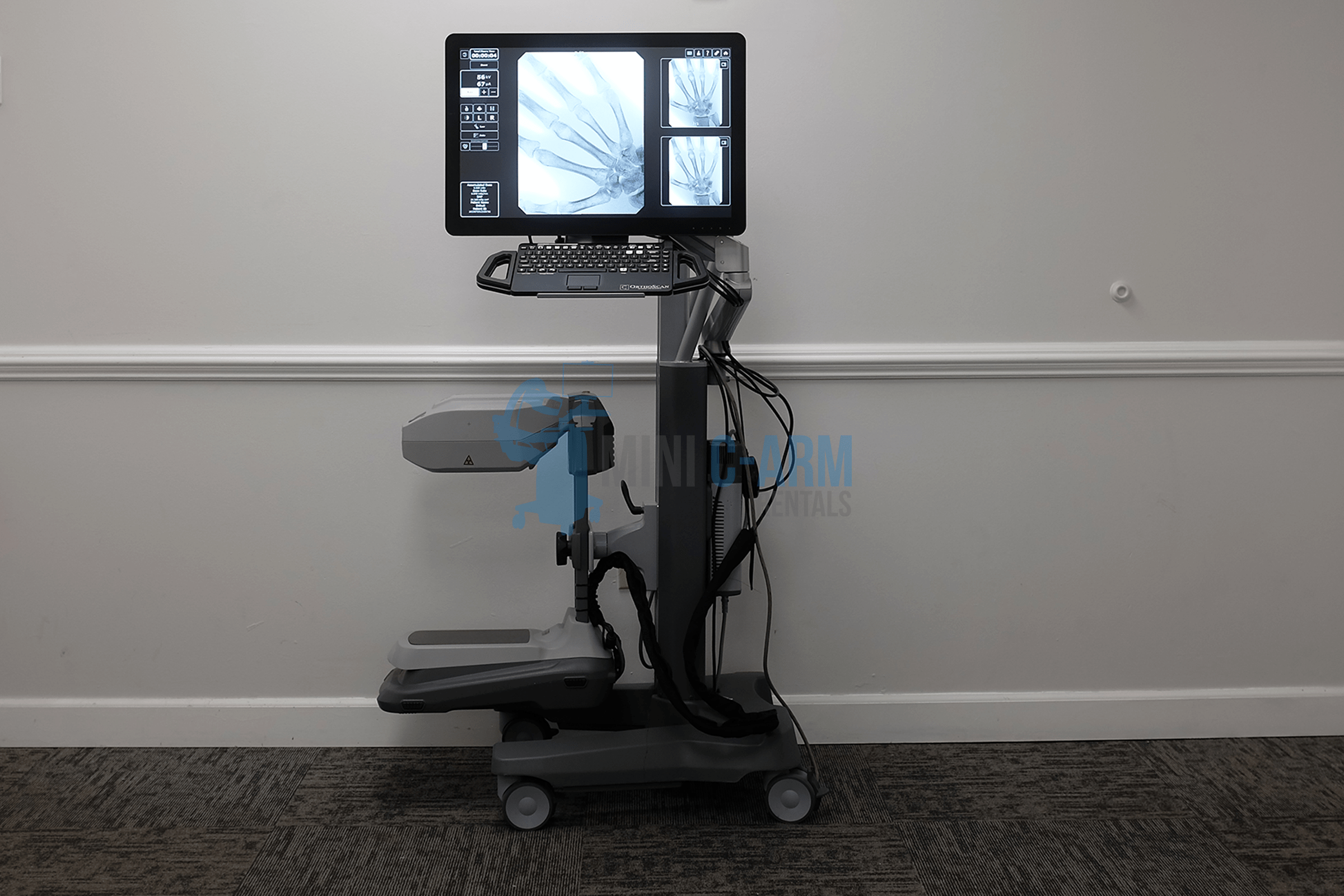 Orthoscan Mobile DI mini c-arm